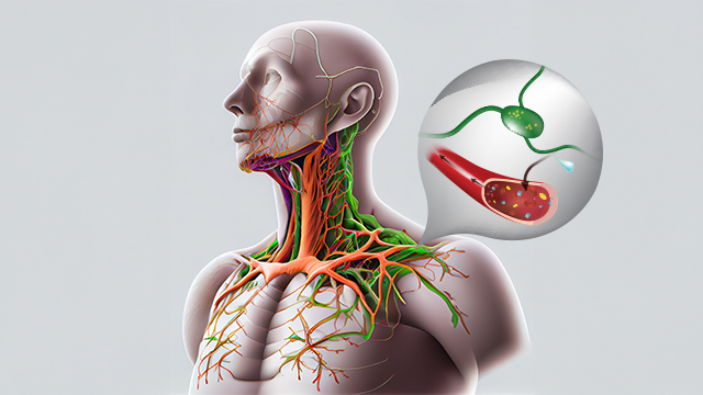 Symptoms and Causes of Lymphoma Cancer