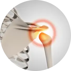 Persistent bone pain