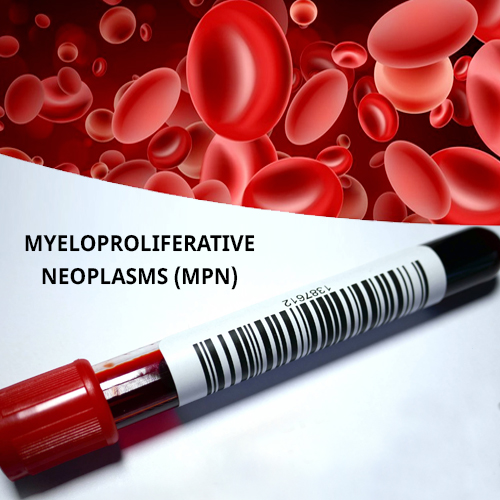 Myeloproliferative Neoplasms (MPN)