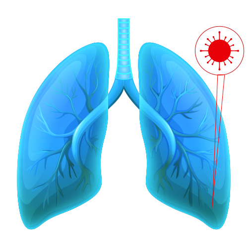 Small cell carcinomas