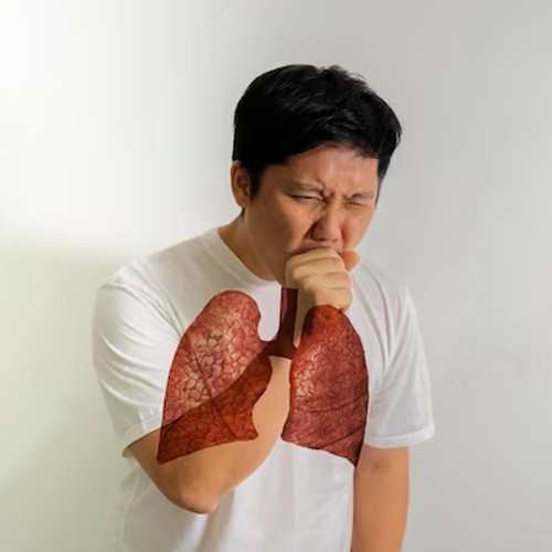 Persistent cough, often with blood