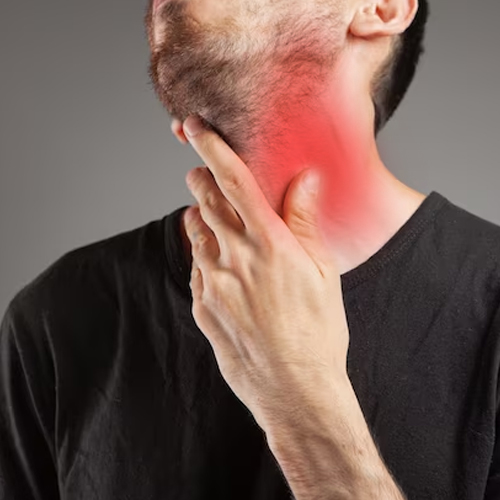 Swelling of the neck or face