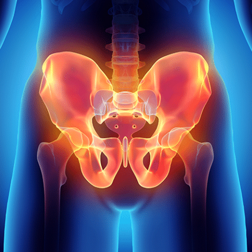 Pain in the pelvic area 