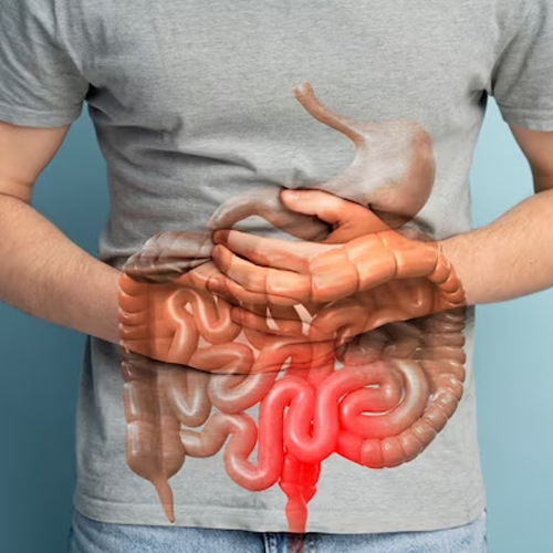 Bowel habit changes