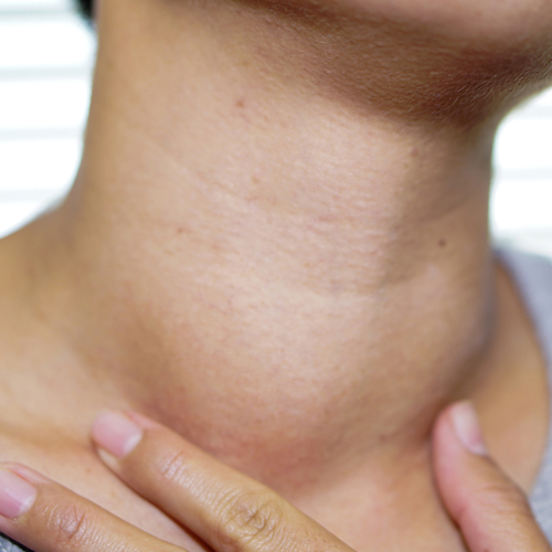 Neck Lump or Swelling