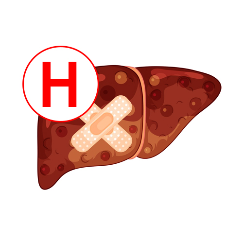 Hepatitis Virus (HCV)