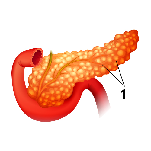 Exocrine Pancreatic Tumors