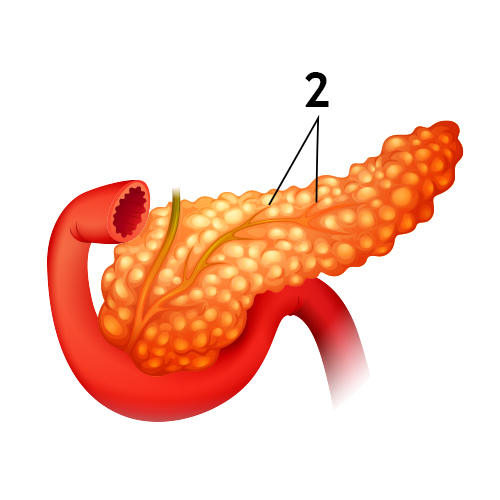 Endocrine Pancreatic Tumors 